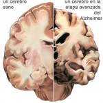 ¿Por qué los enfermos de alzhéimer dejan de reconocer a sus familiares?