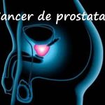 En R D el cáncer de próstata se cobra entre tres y cinco vidas al día