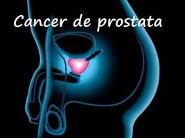 Imagen cáncer de prostata