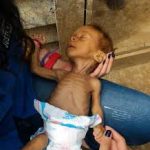 Cáritas Venezuela: 280.000 niños podrían morir por desnutrición