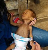  Niños mueren de hambre en Venezuela