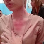 En Venezuela la policía agredió  a médicos durante protesta