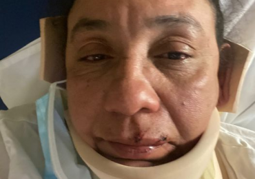 Periodista dominicana de Filadelfia denunció haber sido severamente golpeada y maltratada físicamente por su pareja sentimental